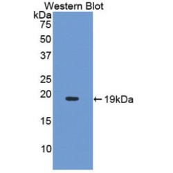 Interleukin 17A (IL17A) Antibody