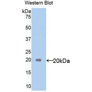 abx101192