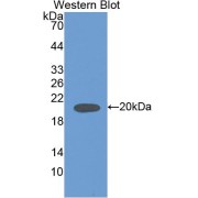 abx101193