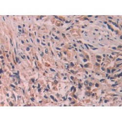 Interleukin 24 (IL24) Antibody