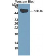 Western blot analysis of the recombinant protein.