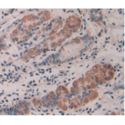 Interleukin 35 (IL35) Antibody