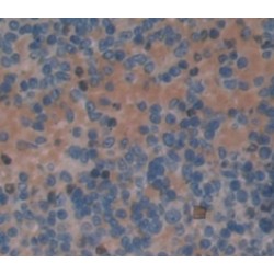 Myeloperoxidase (MPO) Antibody