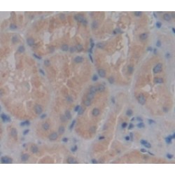 Pappalysin 2 (PAPPA2) Antibody