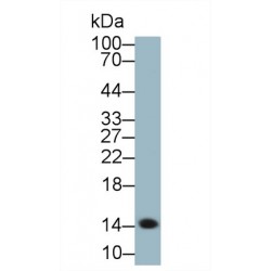 Serum Amyloid A (SAA1) Antibody