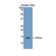 Western blot analysis of recombinant Human SAA1.