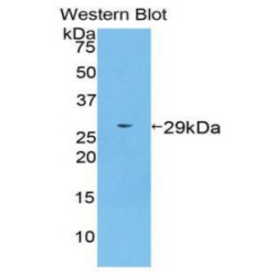 Transportin 1 (TNPO1) Antibody