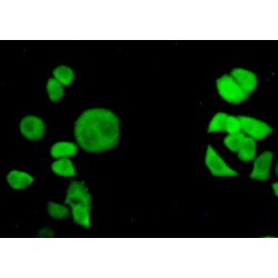 Transportin 1 (TNPO1) Antibody