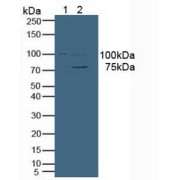 Western blot analysis of (1) Human Jurkat Cells and (2) Human HeLa cells.