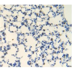 Androgen Receptor (AR) Antibody