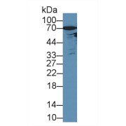 Western blot analysis of Rat Serum, using Rat AR Antibody (3 µg/ml) and HRP-conjugated Goat Anti-Rabbit antibody (<a href="https://www.abbexa.com/index.php?route=product/search&amp;search=abx400043" target="_blank">abx400043</a>, 0.2 µg/ml).