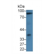 Western blot analysis of Rat Heart lysate, using Mouse CDHH Antibody (2 µg/ml) and HRP-conjugated Goat Anti-Rabbit antibody (<a href="https://www.abbexa.com/index.php?route=product/search&amp;search=abx400043" target="_blank">abx400043</a>, 0.2 µg/ml).