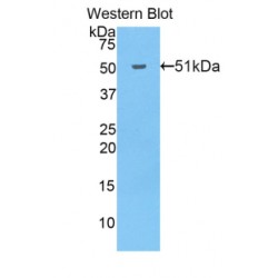 Cadherin-13 (CDH13) Antibody
