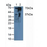 Western blot analysis of (1) Human Liver Tissue and (2) Human Blood Cells.