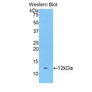 Western blot analysis of the recombinant protein.