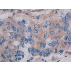 Filamin C Gamma (FLNC) Antibody