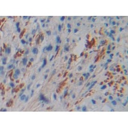 Filamin C Gamma (FLNC) Antibody