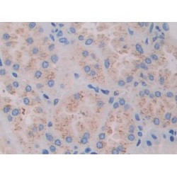 Filamin C Gamma (FLNC) Antibody