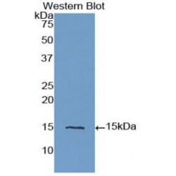 Inhibin Beta A (INHbA) Antibody