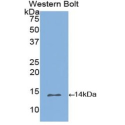 Inhibin Beta B (INHbB) Antibody