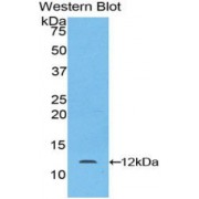 Western blot analysis of the recombinant Mouse LAMb2.