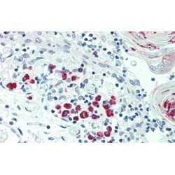 Lymphotoxin Beta (LTb) Antibody