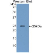 Western blot analysis of the recombinant NEFM protein.