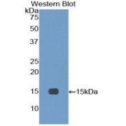 Western blot analysis of the recombinant protein.
