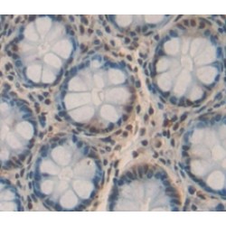 Neurogenin 3 (NEUROG3) Antibody