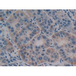 Olfactomedin 4 (OLFM4) Antibody