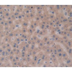 Vasopressin-Neurophysin 2-Copeptin (AVP) Antibody