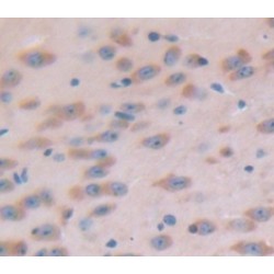 Semaphorin 3A (SEMA3A) Antibody