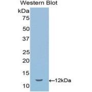 Western blot analysis of the recombinant protein.