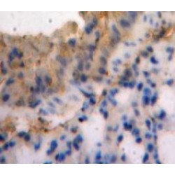 Semaphorin 3E (SEMA3E) Antibody
