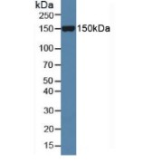 Western blot analysis of Mouse Serum.