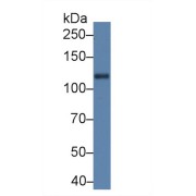 Western blot analysis of Rat Cerebrum lysate, using Rat Slit1 Antibody (5 µg/ml) and HRP-conjugated Goat Anti-Rabbit antibody (<a href="https://www.abbexa.com/index.php?route=product/search&amp;search=abx400043" target="_blank">abx400043</a>, 0.2 µg/ml).