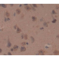 Slit Homolog 2 (SLIT2) Antibody