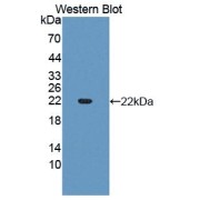 Western blot analysis of recombinant Human SLIT3 protein.
