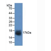 Western blot analysis of recombinant Human SNCa.