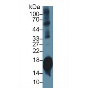 Western blot analysis of Mouse Cerebrum lysate, using Mouse SNCa Antibody (1 µg/ml) and HRP-conjugated Goat Anti-Rabbit antibody (<a href="https://www.abbexa.com/index.php?route=product/search&amp;search=abx400043" target="_blank">abx400043</a>, 0.2 µg/ml).