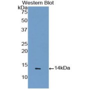 Western blot analysis of the recombinant protein.