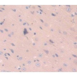 Alpha Synuclein (SNCA) Antibody