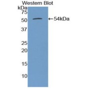 Western blot analysis of the recombinant protein.