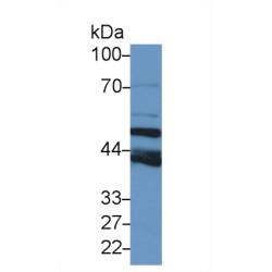 Tubulin Beta 6 (TUBB6) Antibody