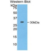 WB analysis of the recombinant Mouse TUBB6 protein.