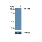 Western blot analysis of (1) Wild-type HeLa cell lysate, and (2) ACTN2 knockout HeLa cell lysate, using Rabbit Anti-Mouse ACTN2 Antibody (1 µg/ml) and HRP-conjugated Goat Anti-Mouse antibody (<a href="https://www.abbexa.com/index.php?route=product/search&amp;search=abx400001" target="_blank">abx400001</a>, 0.2 µg/ml).