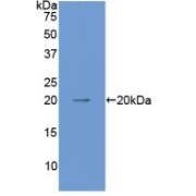 abx101427