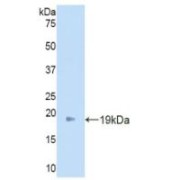 abx101434