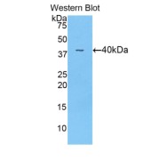 abx101438