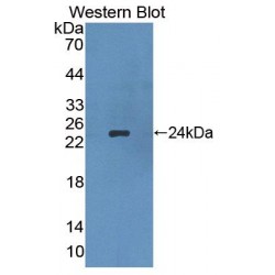 Apolipoprotein B (APOB) Antibody